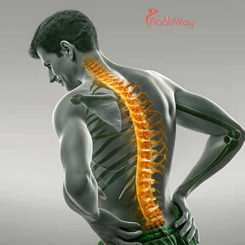 Stem Cell Therapy for Degenerative Disc Disease in Colombia: Things to Know